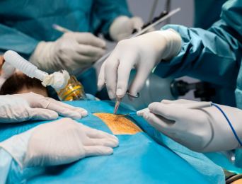 OG Surgery at JP Hospital